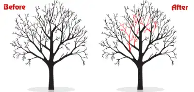 Crown Thinning
